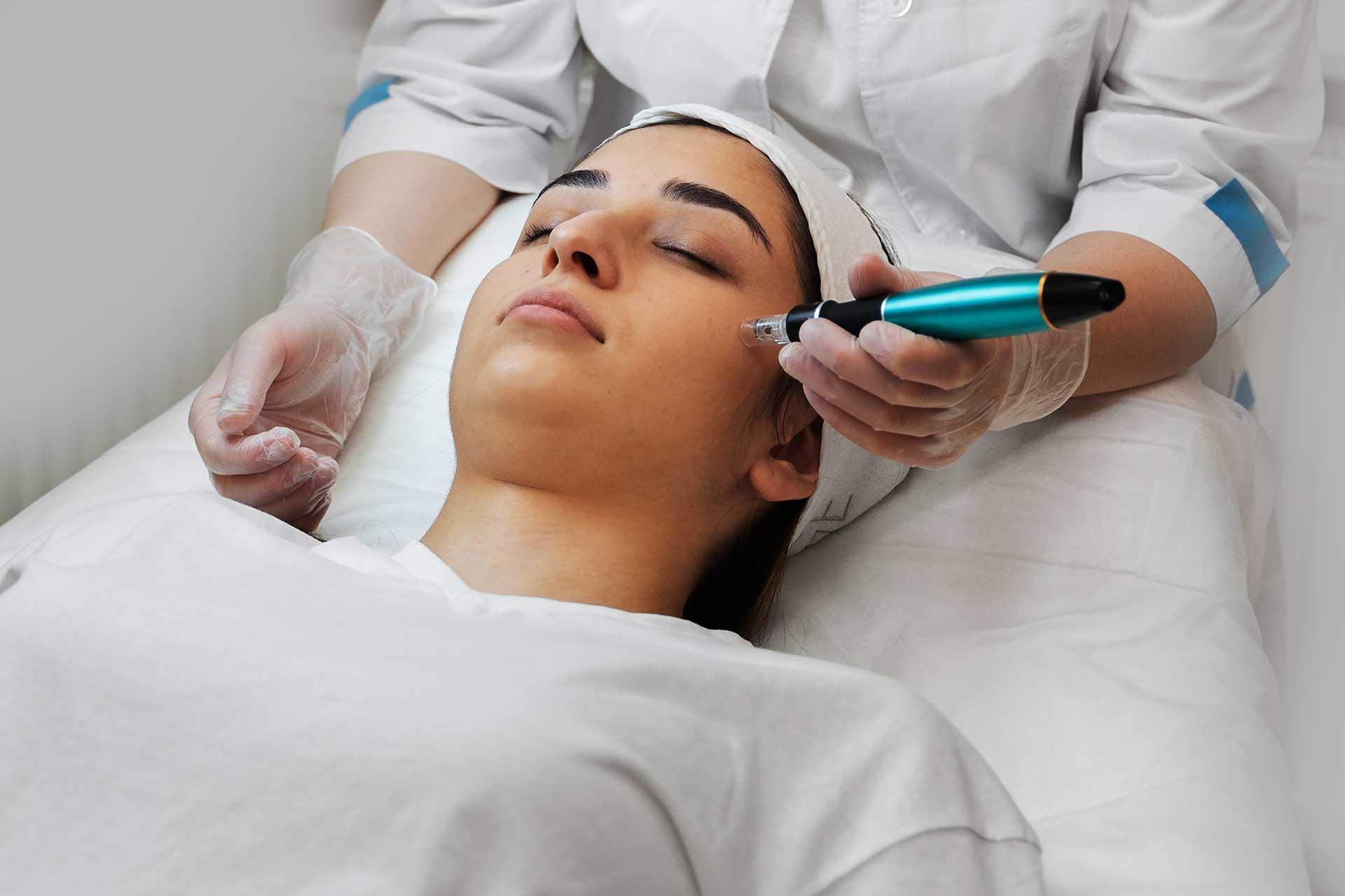 Micro-Needling